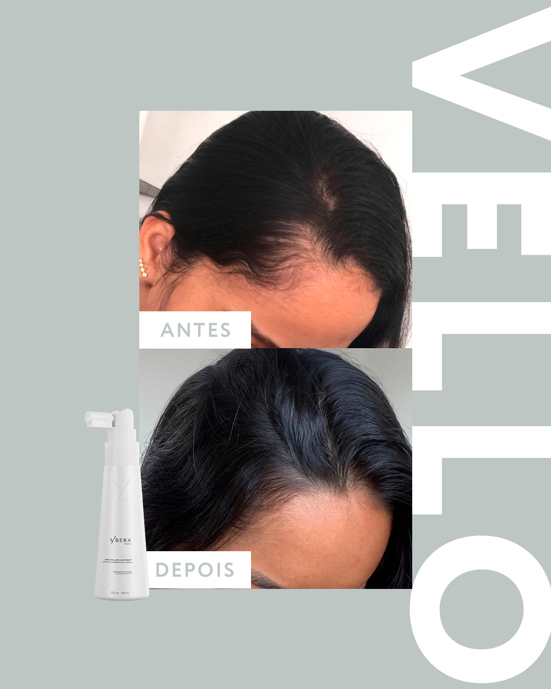 Vello Kit + Shampoo 250ml + Mask 200g + Scalp Serum 90ml